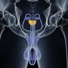 Prostate Diseases